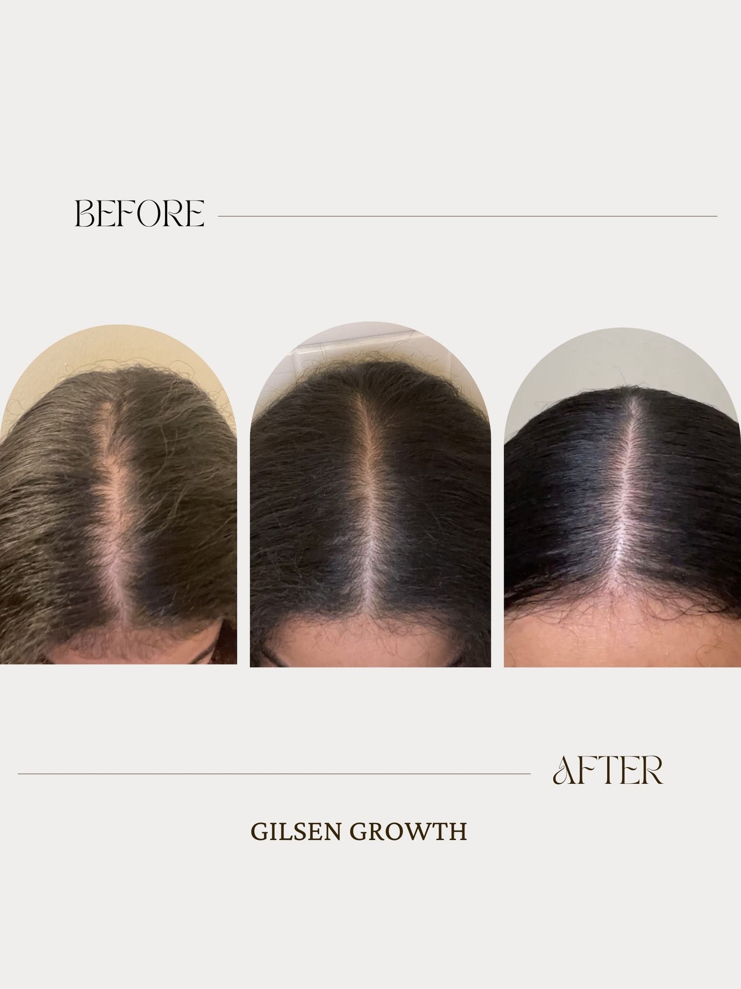 SCALP TREATMENT 4oz