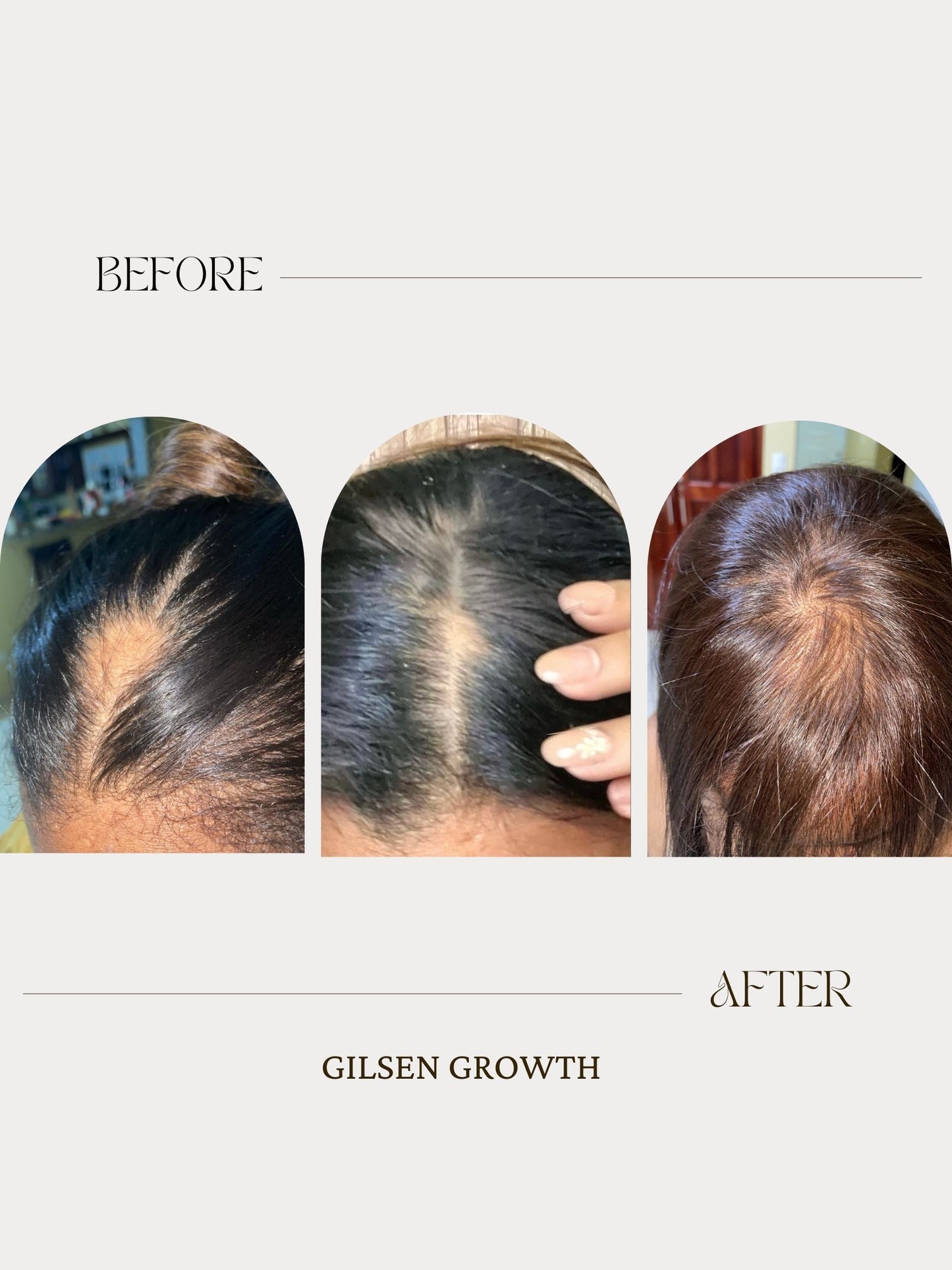SCALP TREATMENT 4oz
